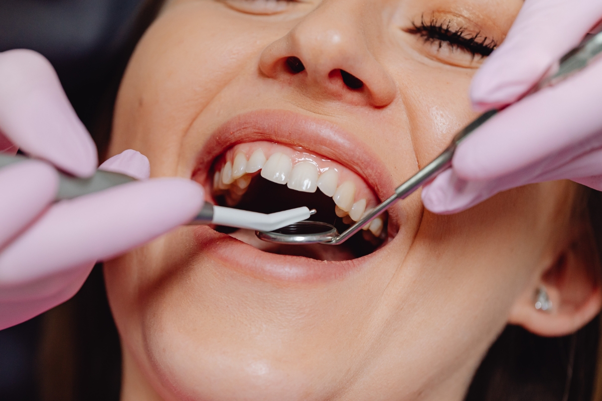 Root Canal Treatment